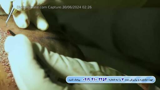 Capture Image OXIR TV 10845 V